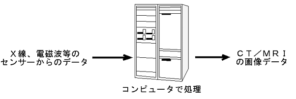 CT/MRIイメージ生成概念図